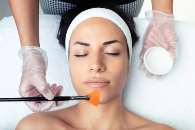 Chemical Peels