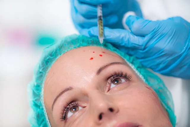 PRP (Platelet-Rich Plasma)
